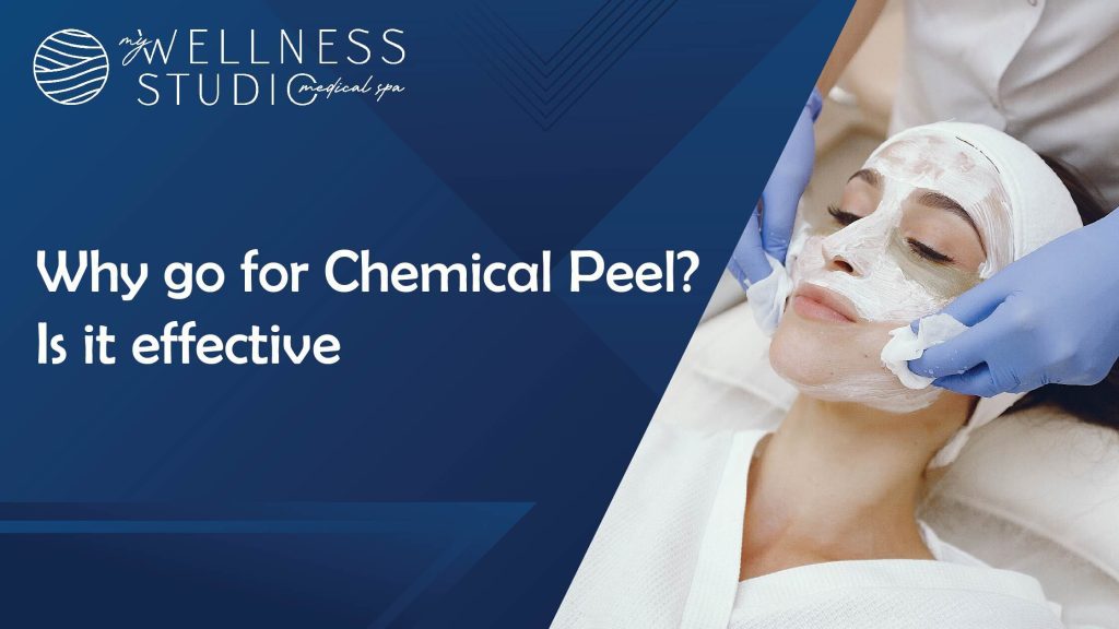 chemical peel
